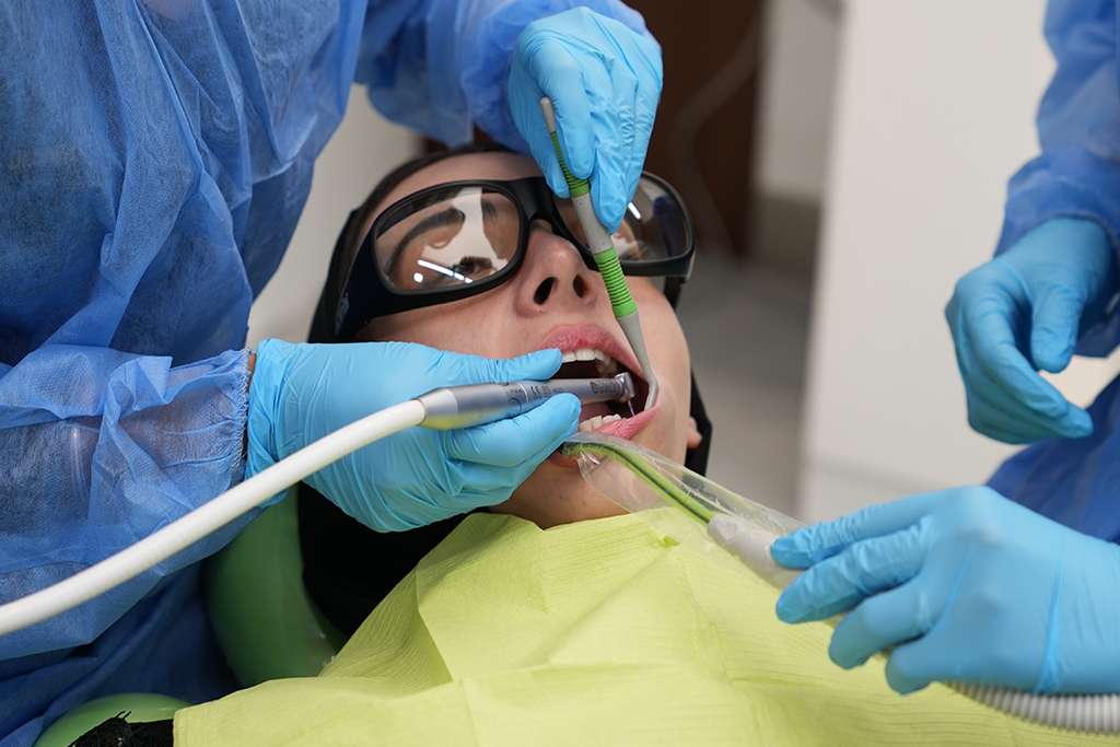 Laser Cavity Removal