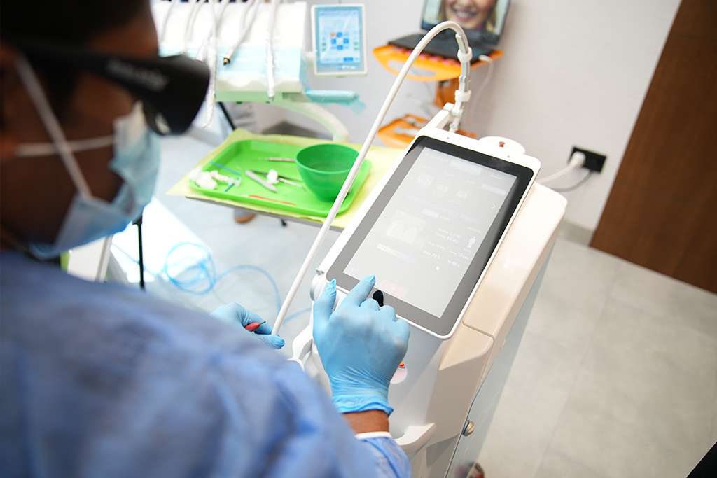 Laser Dental Fillings