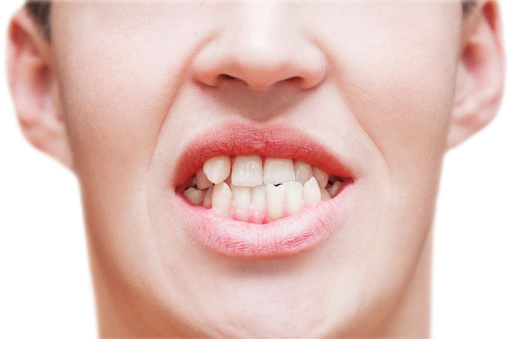 TMJ---Advanced-Treatments