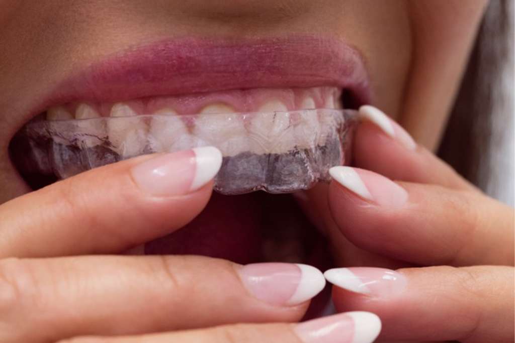 TMJ---COnservative-Treatments