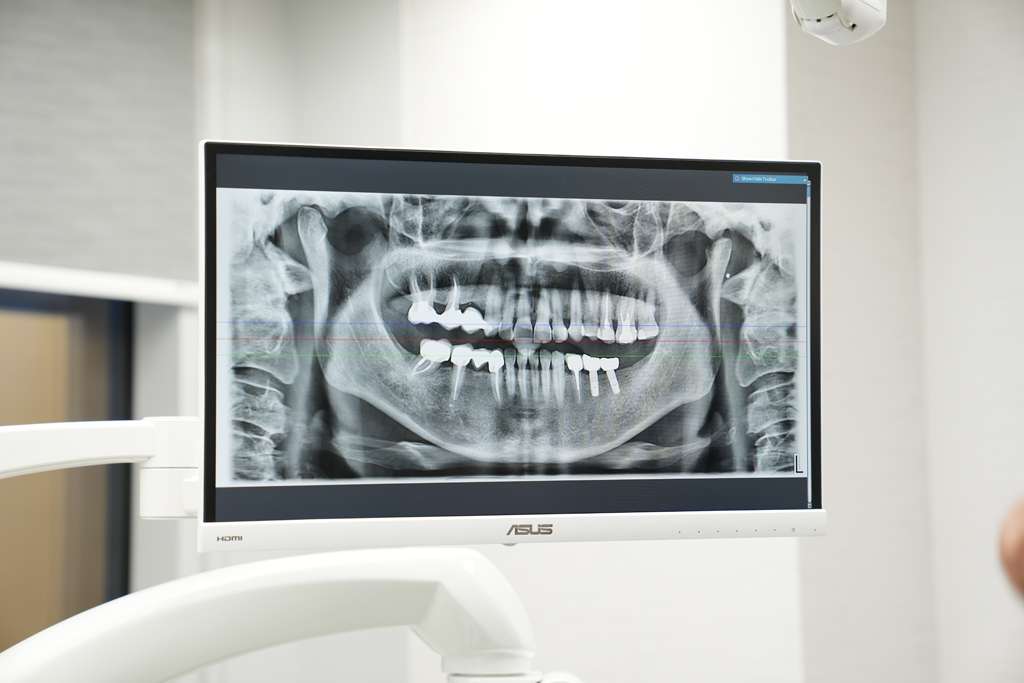 dental x-ray